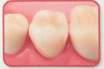 allceramic